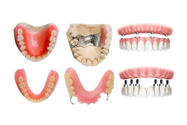 Protetică dentară – coroane, punți și proteze dentare în Iași